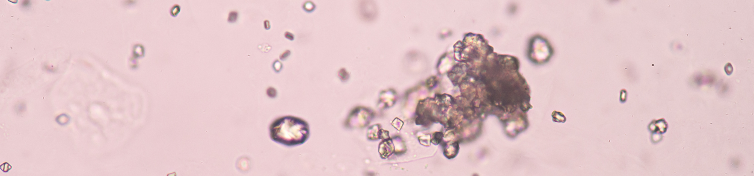 Dna moczanowa - co to jest