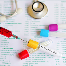 Rozpoznanie dny moczanowej