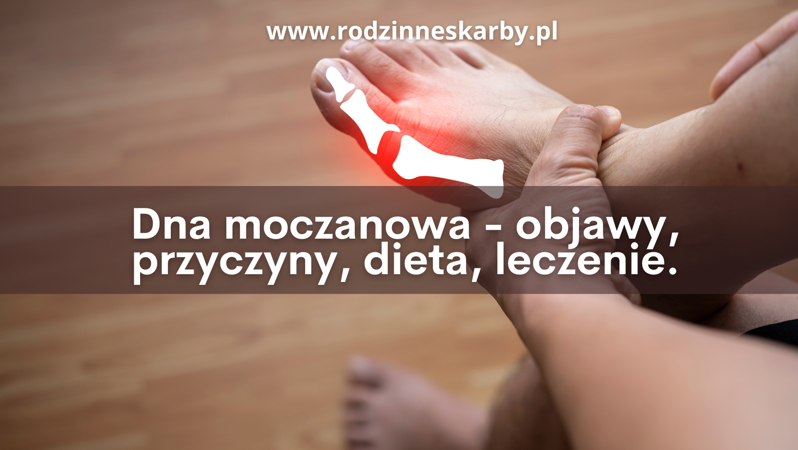 dna moczanowa objawy przyczyny dieta leczenie suplementy