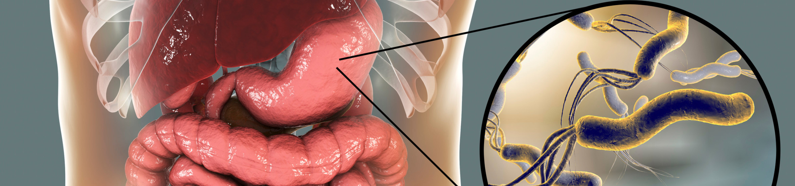 zapalenie zoladka helicobacter pylori bakteria