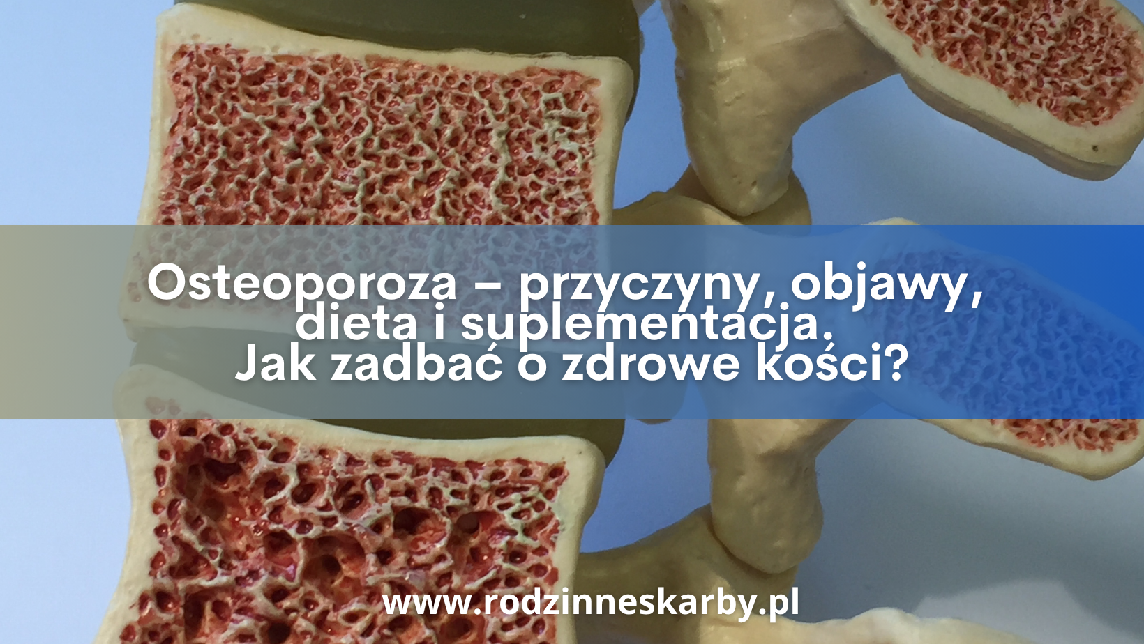 osteoporoza przyczyny objawy dieta i suplementacja jak zadbac o zdrowe kosci